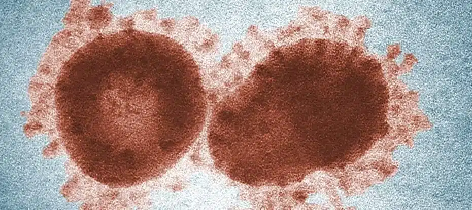 IA pode ajudar a prever futuras pandemias