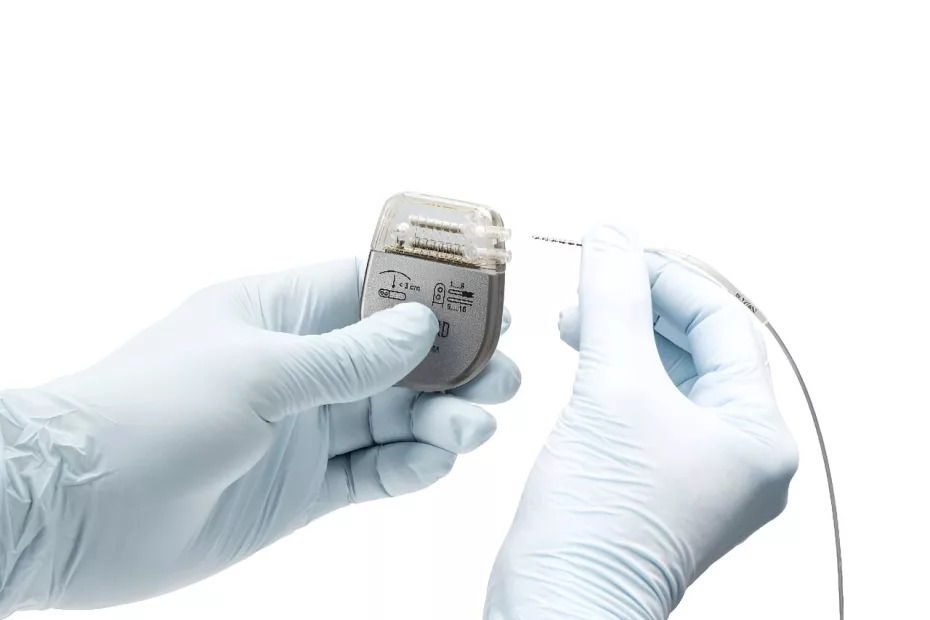 Implantes cerebrais podem restaurar os movimentos dos braços de pacientes paralisados