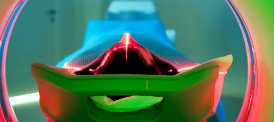 Pacientes com COVID longa têm mais probabilidade de apresentar anormalidades em múltiplos órgãos